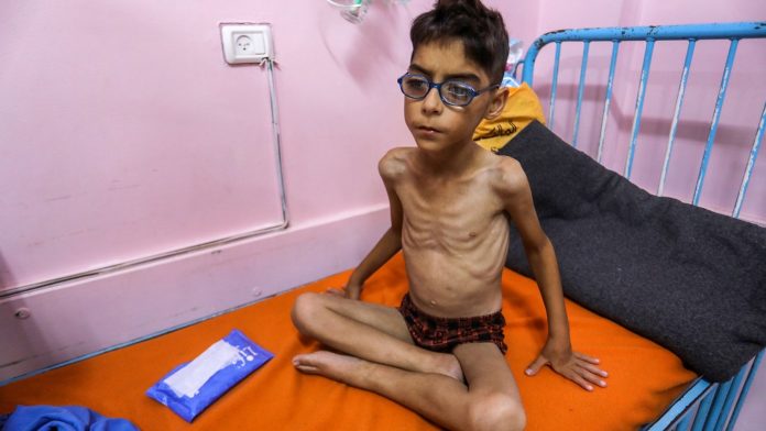 Doctor can 'see every rib' on starving children in Gaza