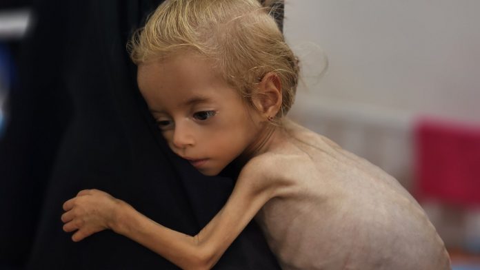 Famine has struck Gaza, says global hunger monitor