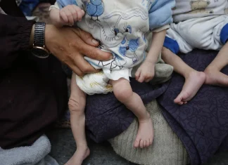 UN: Nearly 4.9 million under-five children lost their lives worldwide in 2024 Around 4.9m children under five died in 2024, says UN