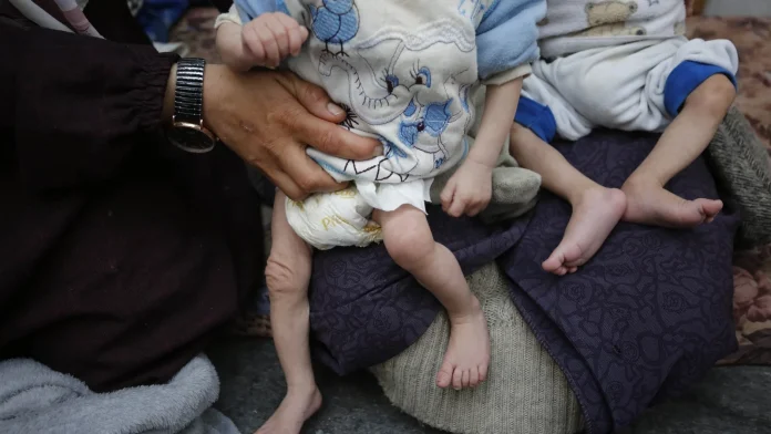 Around 4.9m children under five died in 2024, says UN